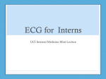 ECG for Interns