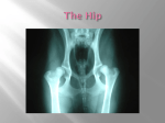 The Hip