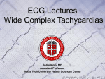 Wide Complex Tachycardias - Texas Tech University Health