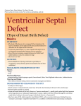 ventricular_septal_defect