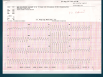 approach to wide qrs complex tachycardia