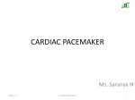 cardiac pacemaker