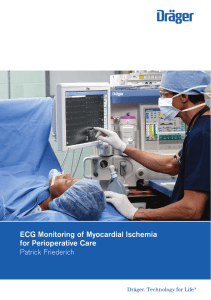 ECG Monitoring of Myocardial Ischemia for Perioperative