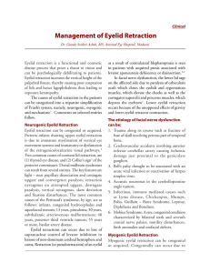 Management of Eyelid Retraction