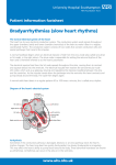 Bradyarrhythmias - patient information