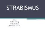 strabismus