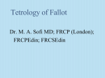 Tetrology of fallot