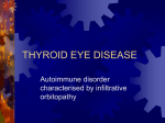 thyroid eye disease - Diabetic Retinopathy