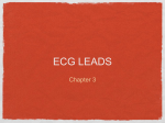 03 ECG Leads