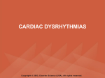 dysrhythmias