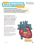 I Have Mitral Regurgitation, Now What?