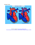 Tetralogy of Fallot