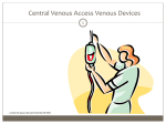 Central Venous Catheters (CVC)
