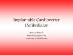 Implantable Cardioverter Defibrillator