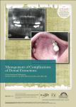 Management of Complications of Dental Extractions