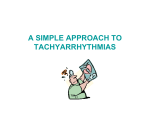 A SIMPLE APPROACH TO TACHYARRHYTHMIAS