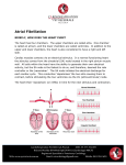 Atrial Fibrillation Explained - New