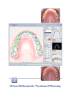 Virtual Orthodontic Treatment Planning