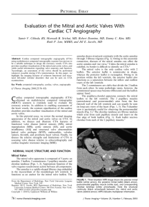 Evaluation of the Mitral and Aortic Valves With Cardiac CT