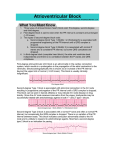 Atrioventricular Block - Core Concepts Anesthesia Review