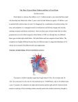 Treating Three Types of Heart Failure