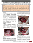 surgical exposure of un-erupted teeth for orthodontics