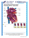 (TAPVC): Supracardiac - Children`s Heart Clinic