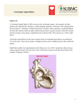 Ventricular Septal Defect