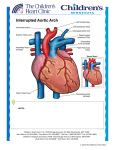 Interrupted Aortic Arch (IAA)