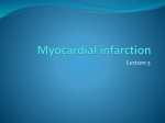 Myocardial infarction - Lectures For UG-5