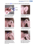 How to fit a LEFT ear mould and a Behind the Ear Hearing Aid.