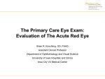 Evaluation of the Red Eye