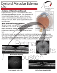 Cystoid Macular Edema - Retina Consultants of Houston