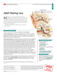 Adult Hearing Loss - Hearing Solutions of North Georgia