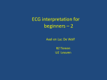 ECG interpretation for beginners * 2 Axel en Luc De Wolf
