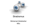 Strabismus