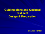 Guiding plane and Occlusal rest seat Design
