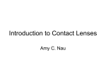 Introduction to Contact Lenses