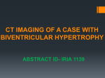 CT IMAGING OF A CASE WITH BIVENTRICULAR HYPERTROPHIC