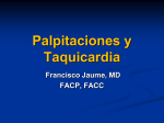 Palpitaciones y taquicardia