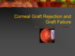 Corneal Graft Rejection