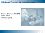 MR Guided Focused Ultrasound Surgery