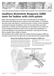 Auditory Brainstem Response (ABR)