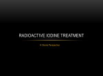 Radioactive Iodine treatment