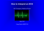 ECG Analysis - Antrim ED Meducation