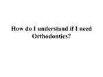 How do I understand if I need Orthodontics?