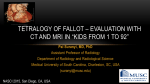 Tetralogy of Fallot
