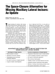 The space-closure alternative for missing maxillary lateral incisors