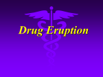 Treatment of severe drug eruption