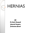 Hernias